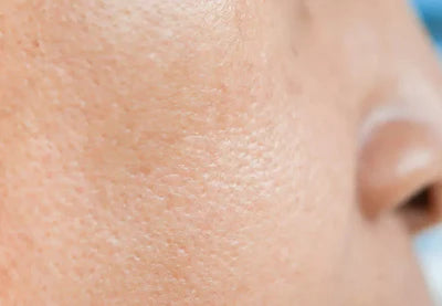 Open Pores